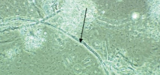 Проактивный контроль роста микроорганизмов и оптимизация стратегий биоконтроля е
